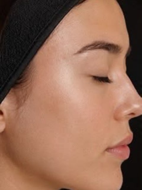 Fewer Breakouts, after, example 2