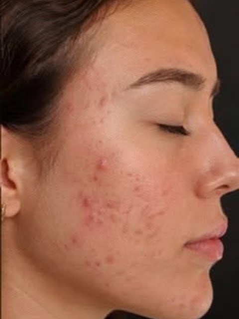 Fewer Breakouts, before, example 2