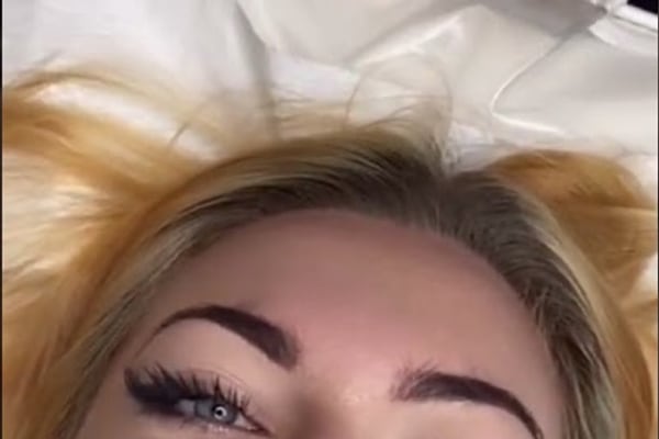 Lip rejuvenation treatment video