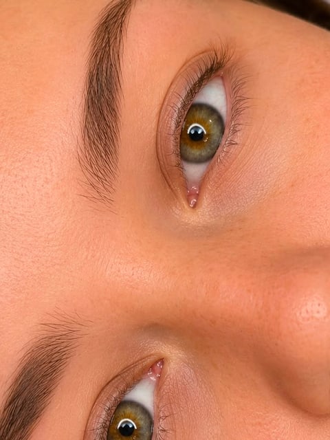 Before, example 2